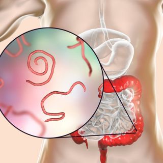 Eltávolítja a méreganyagokat és salakanyagokat